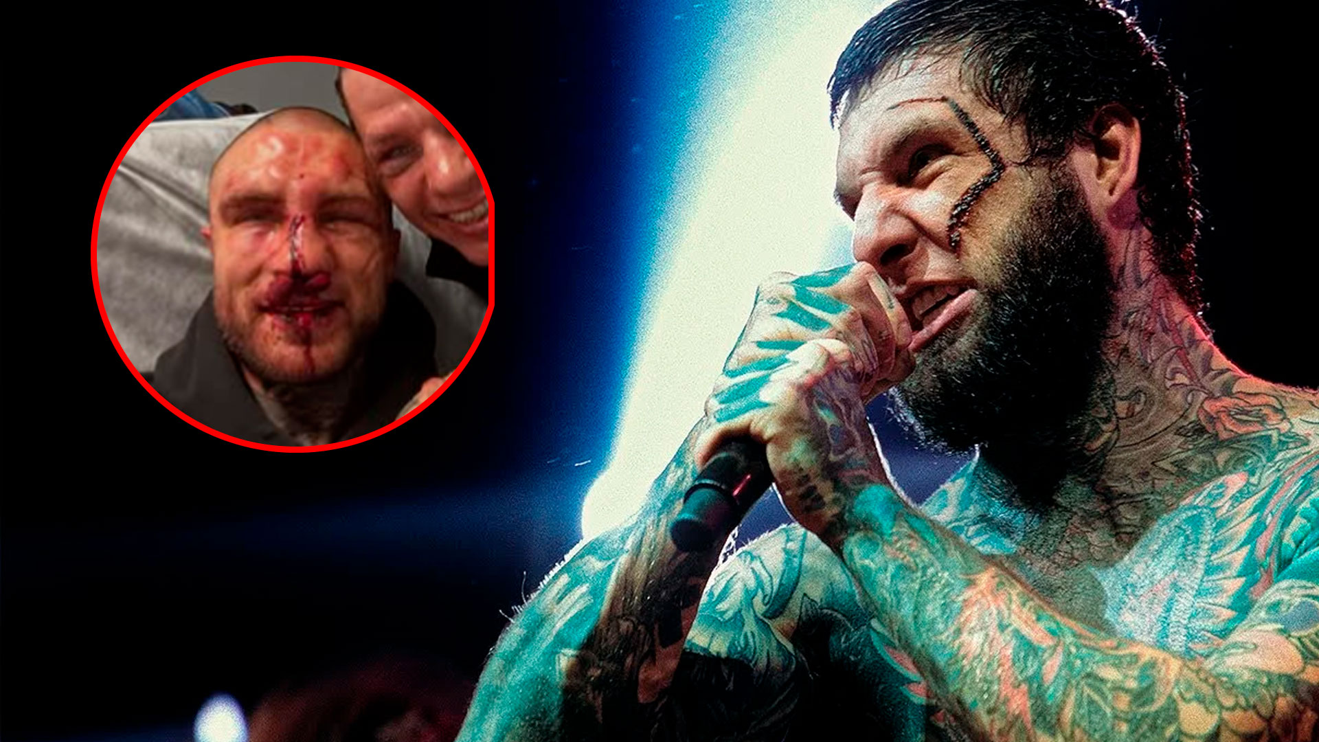 Alex Terrible mostra resultado após luta livre sem luvas